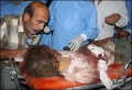 120_iraqi_girl_seriously_injured_in_falluja.jpg