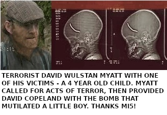 DAVID WULSTAN MYATT WITH SOME OF HIS 'COLLATERAL DAMAGE' - A FOUR YEAR OLD CHILD WITH A NAIL EMBEDDED IN HIS SKULL.