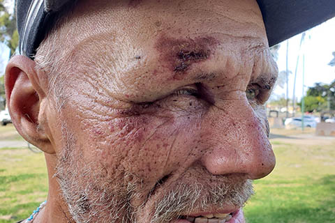 Homeless Man Pummeled by Fresno Cops